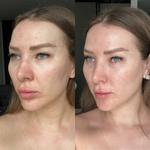Что произойдет с кожей за 21 день с косметикой Доктор Мила?