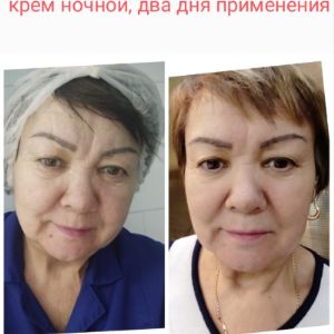 Результаты клиентки