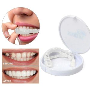 накладные виниры snapon smile