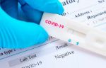 Экспресс-тест для выявления антител COVID-19