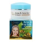 Крем для лица Lady Diana Herbal — Acne & Acne Scar cream (Против Угрей и Прыщей) 80гр